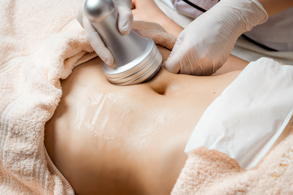 ultrasound cavitation
